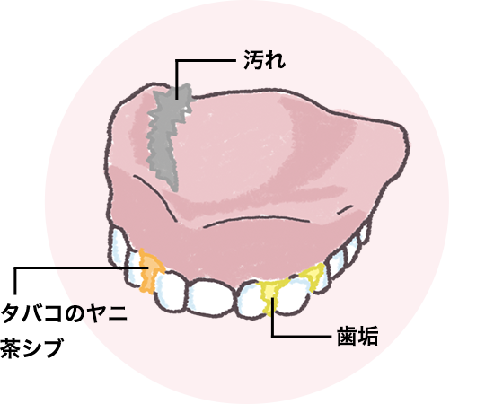 第6回 オーラルフレイル予防としての歯と入れ歯の手入れ法 知っておきたいオーラルフレイル Well噛む シオノギヘルスケア
