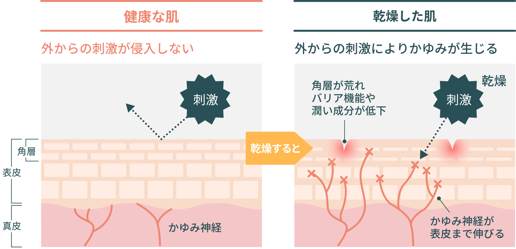 乾燥肌には保湿剤 でもその塗り方 合っていますか 薬局 薬店で相談できる皮膚トラブル 薬局 薬店で相談できる皮膚トラブル ヒフシルワカル