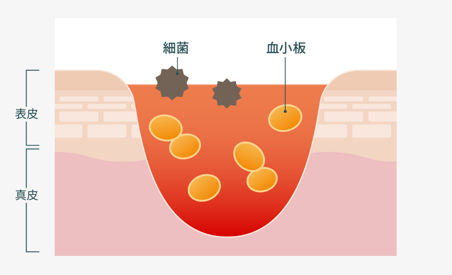 出血凝固期イメージ