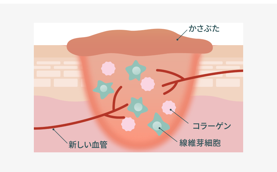 増殖期イメージ