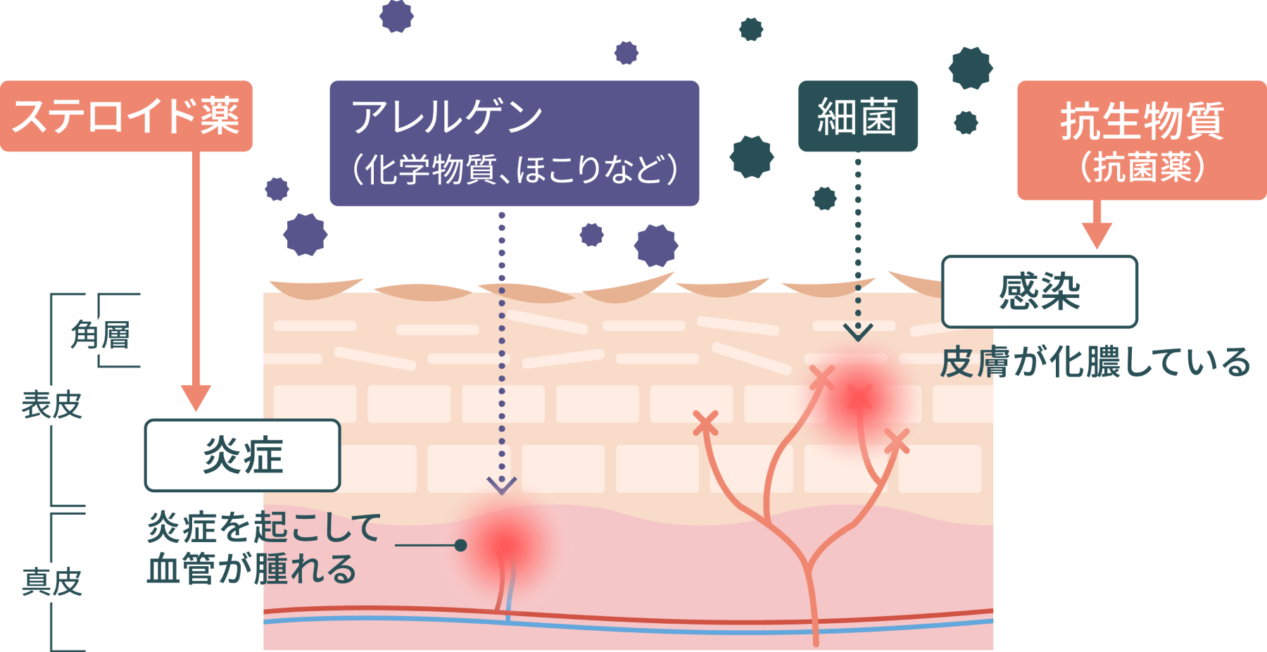 耳の感染症はどのように診断されますか?