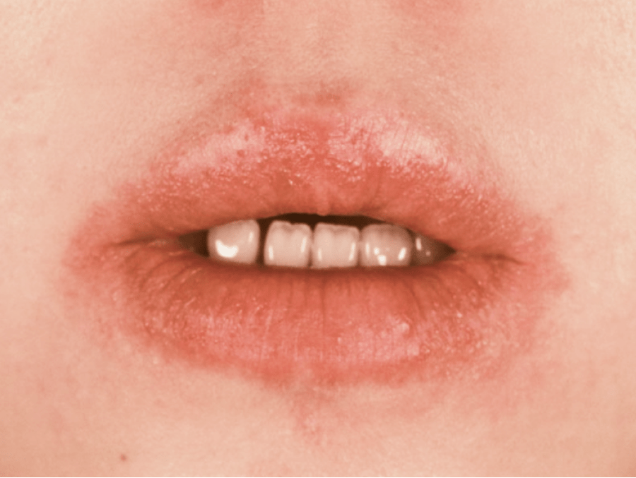 ホームトリートメント