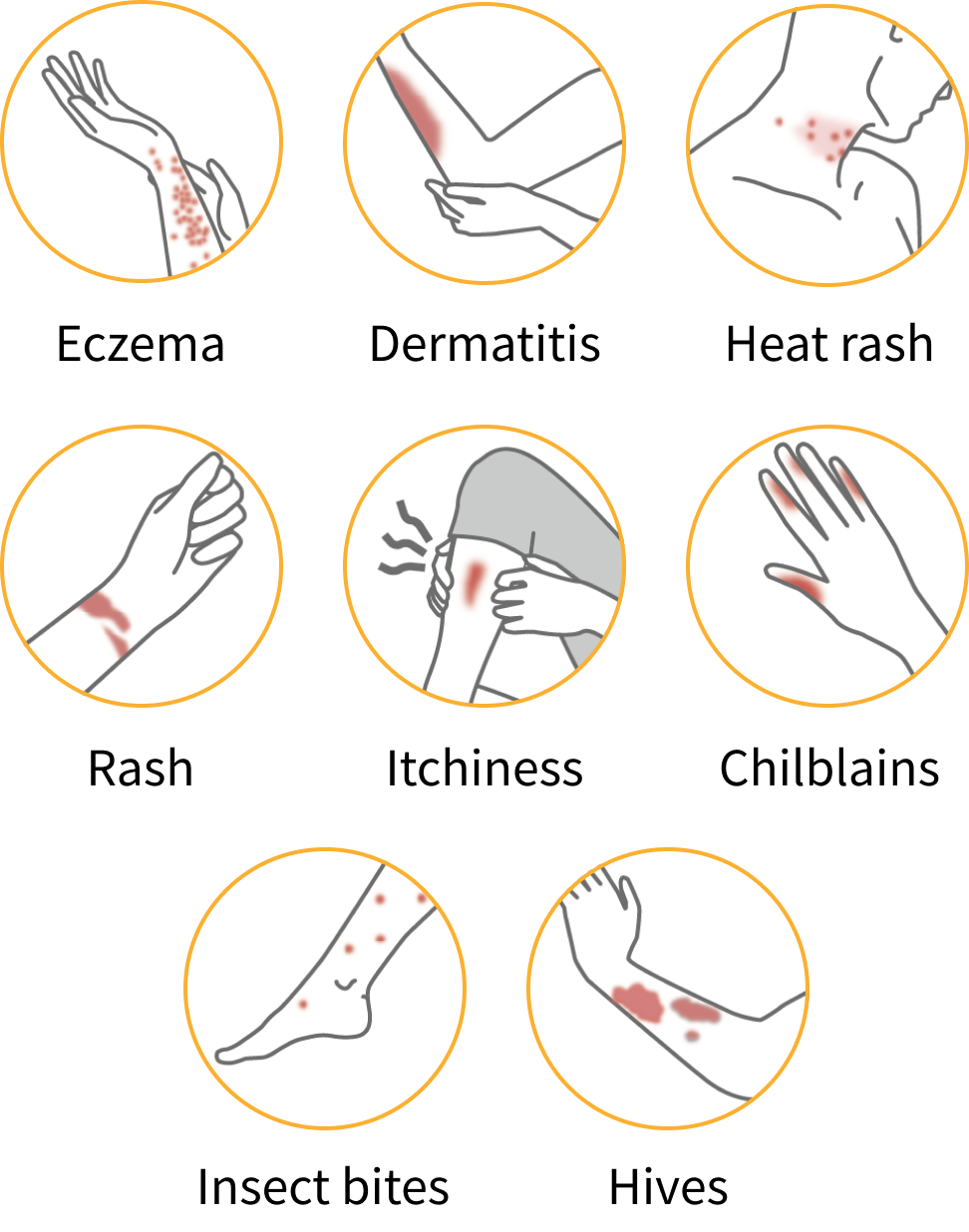 Daily skin troubles and various kinds of dermatitis