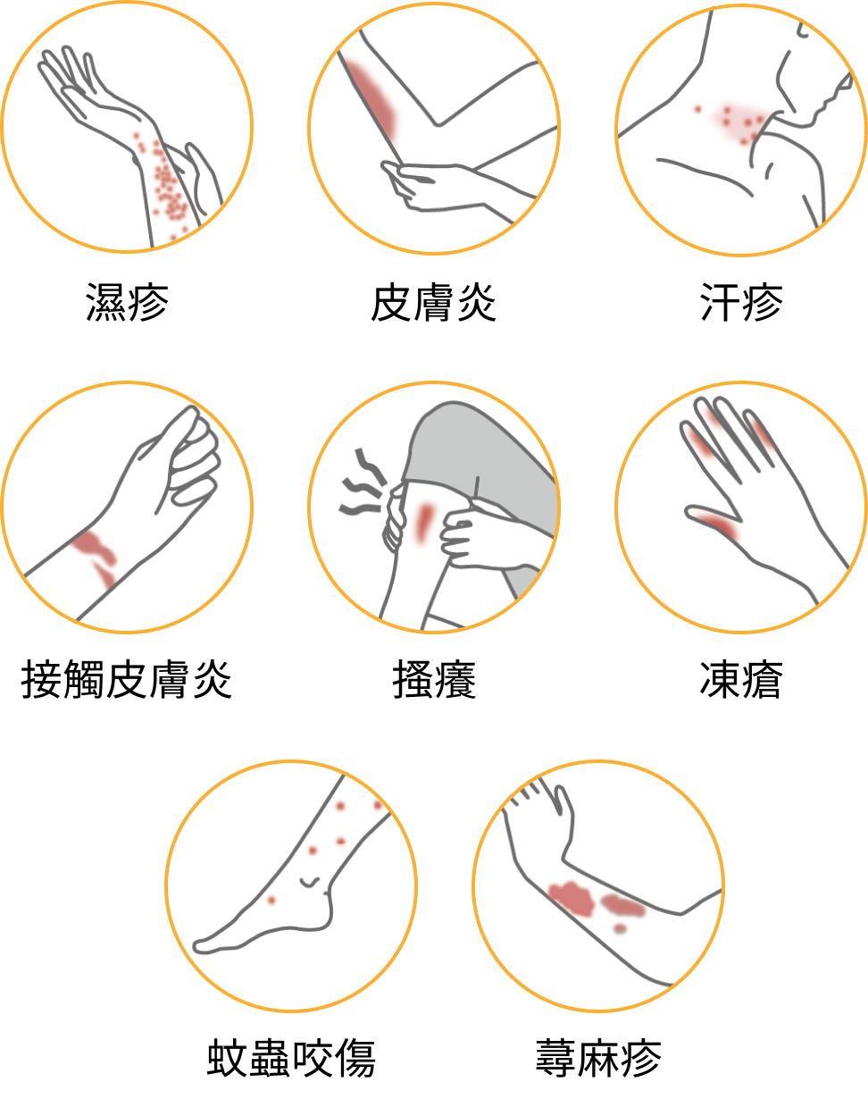 日常的皮膚問題或各種皮膚炎